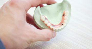 Seven Impressive Benefits of Implant-Supported Partial Dentures in Dacula, GA
