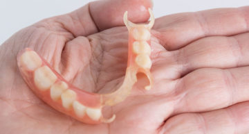 What are Dentures? 