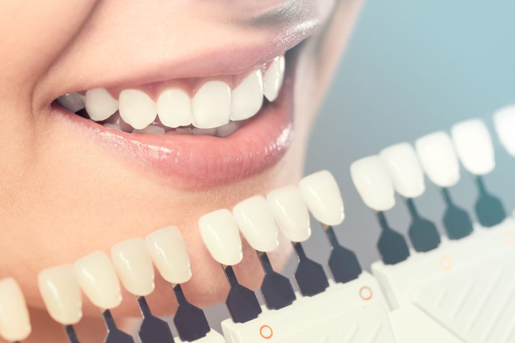 Major Cosmetic Dentistry Procedures You Can Get in Laurel, MD