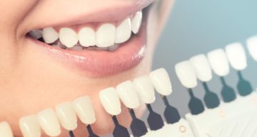 Different Types of Cosmetic Dentistry Procedures in Wichita Falls